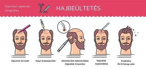 fajta hajápoló kezelések infografika