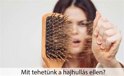 A női hajhullás okai
