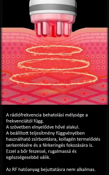 rádiófrekvencia kezelés