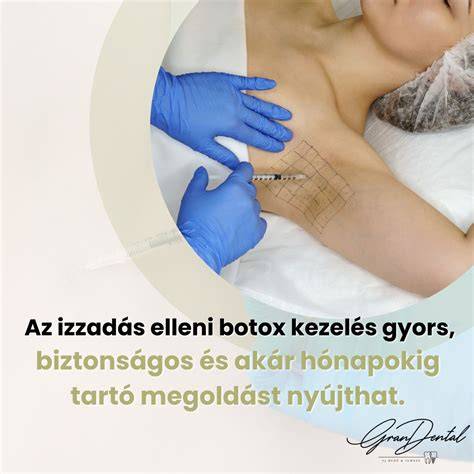Infografika az izzadás okairól és a verejtékmirigyek típusairól