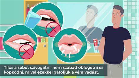 Infografika: hogyan lehet összekapcsolni a melírt és a tapaszt a felnyírt frizurához