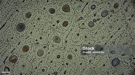 hajszálak mikroszkóp alatt, pigment és levegőbuborék ábrázolása