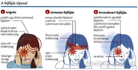 Infografika: szemészeti okok és kapcsolódó fejfájás típusai