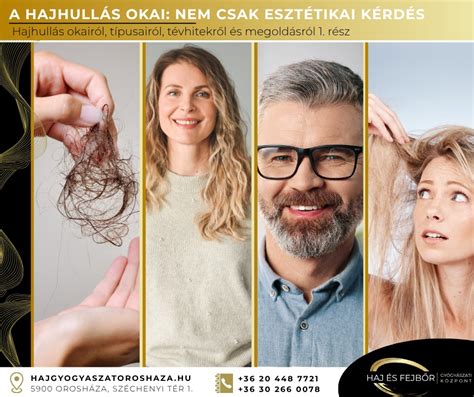 Illusztráció a hajhullás okairól