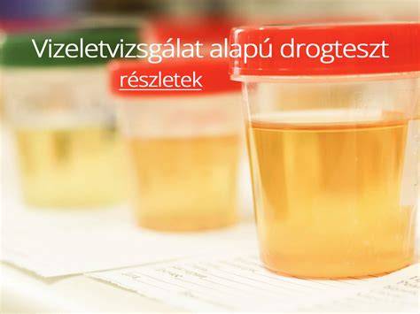 orvosi vizsgálat és labor: vérvétel, pajzsmirigy teszt