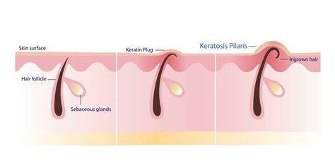 Diagram a keratin-alapú kötőanyagokról