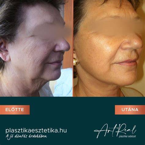 szalonhatás otthon: előtte-utána fotó