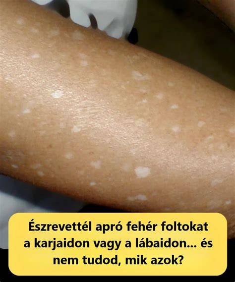 Kutyabőr és fehér foltok vizuális ábrázolása