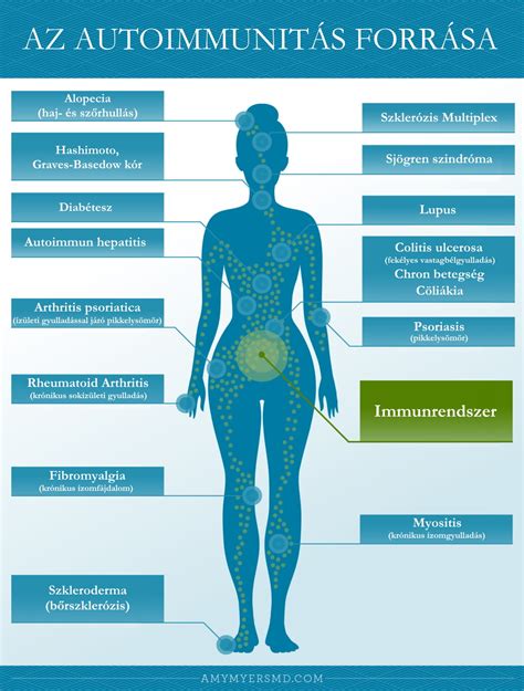 Infografika az autoimmun betegségek és hajhullás kapcsolatáról