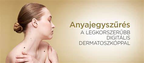Dermatoszkópos anyajegyszűrés folyamata