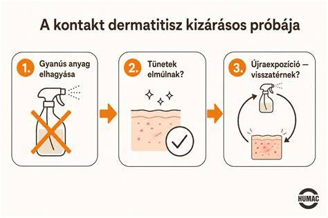 Infografika: hogyan alakul ki allergia a hajfestékben