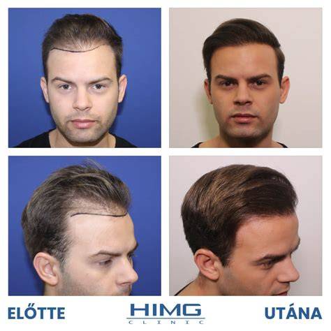 Előtte utána hajak vizuális példák galériában