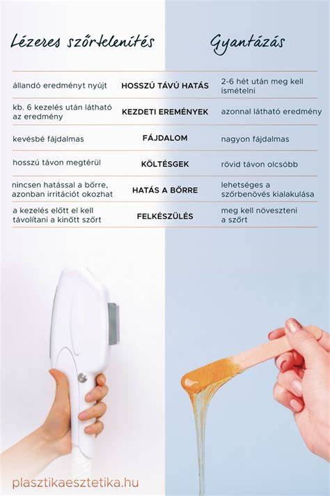 Infografika: Epilálás vs. gyantázás összehasonlítása