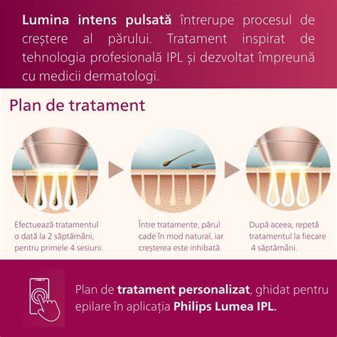 illusztráció az IPL működéséről és a bőrtípusok kontrasztjáról