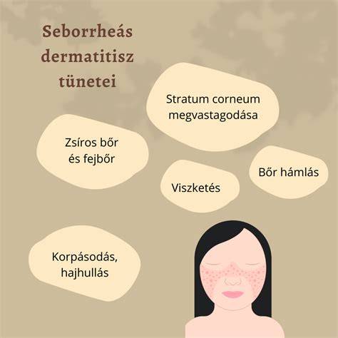 korpásodás és seborrheás dermatitisz grafikon