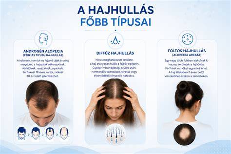 Infografika: Hajhullás okai és kapcsolódó tényezők