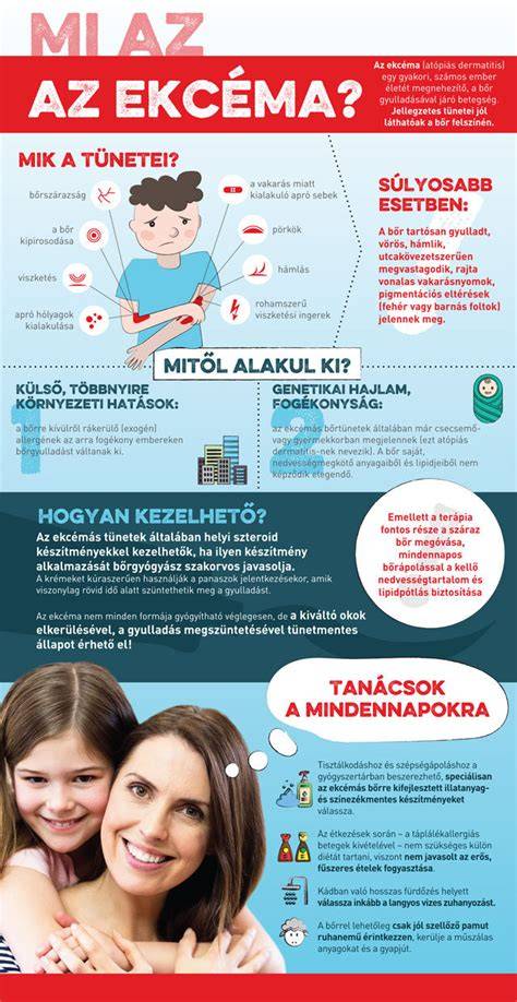Infografika: Ekcéma típusok és triggerok
