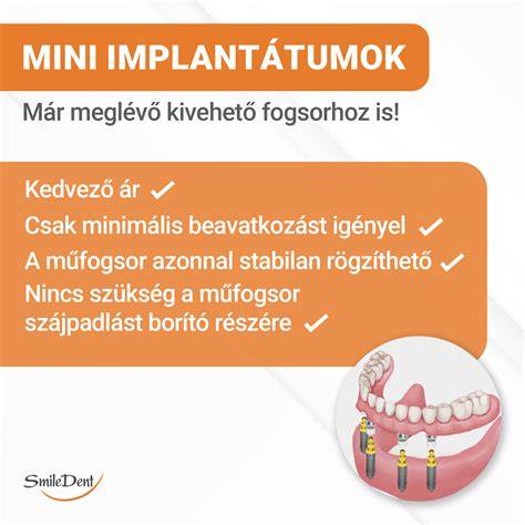 Infografika: hogyan működik az előre-hátra mozgó fogsor a gubancok bontásáért