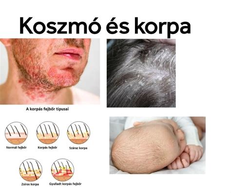 Infografika: Koszmó csecsemőknél - tünetek és kezelés