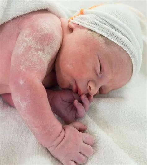 Újszülött bőrfelület és vernix caseosa