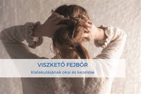 Infografika a viszkető fejbőr okairól és a megoldó sampontípusokról