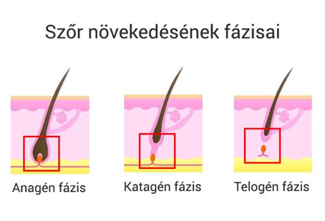 Infografika a szőrtüsző növekedési ciklusáról: anagén, katagén, telogén fázisok