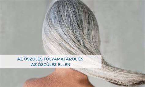 Infografika az őszülés folyamatáról: melanocita működésének csökkenése, pigmentált vs. fehér szálak aránya