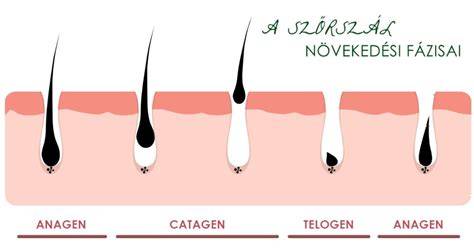 szempontrendszerű szőrtelenítés előtti előkészítés diagram