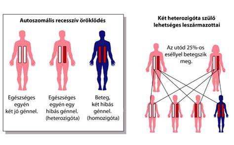 Genetikai ábra: Domináns és recesszív gének öröklődése a haj és szem színében