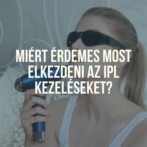 Diagram: végleges szőrtelenítés - mikor és hol érdemes elkezdeni?