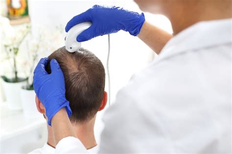 női hormonális hajhullás vizsgálata és kezelés