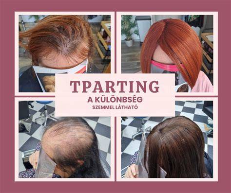 HairContrast hajpótlási technika ábrája