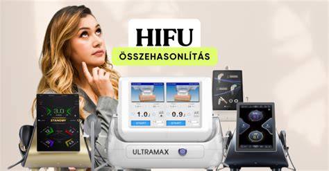 Szőrtelenítő gépek összehasonlítása grafikus