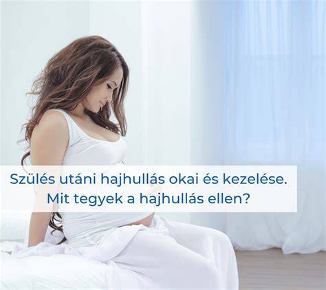 hajhullás szülés utáni vizuális áttekintés