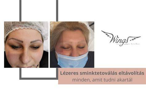 Infografika a műszempilla eltávolítás lépéseiről