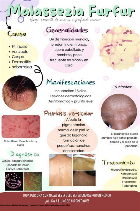 Infografika: Malassezia furfur szerepe a korpásodásban