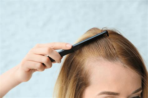 A hajhullás csökkentésének fontossága