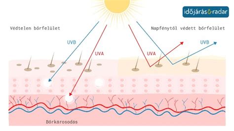 Infografika: UV-sugárzás hatása a bőrre és a melanoma kockázati tényezői