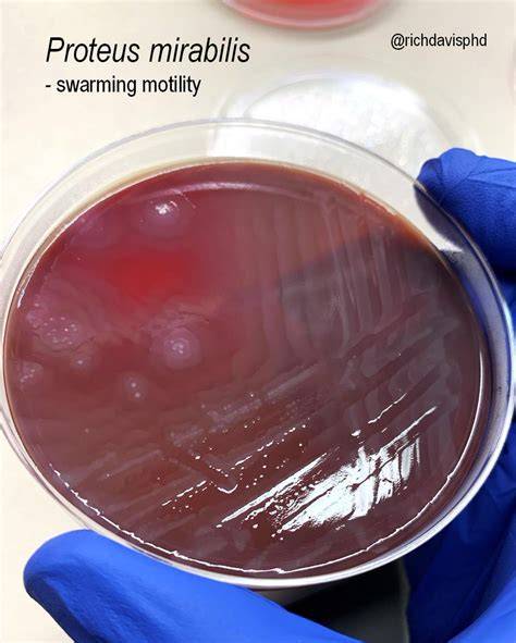 Proteus mirabilis kórokozó morfológiája és ureáz-termelő képessége vizuális ábrán