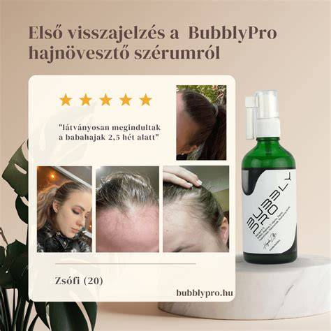 Top 5 hajnövesztő és haj erősítő szérumok listája (példák)