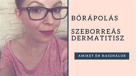 Természetes összetevők a szeborreás dermatitisz kezelésében