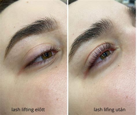 Lash lifting előtt és után összehasonlítás