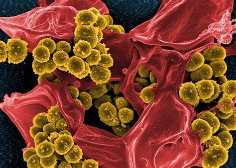 Staphylococcus aureus baktérium mikroszkópos képe