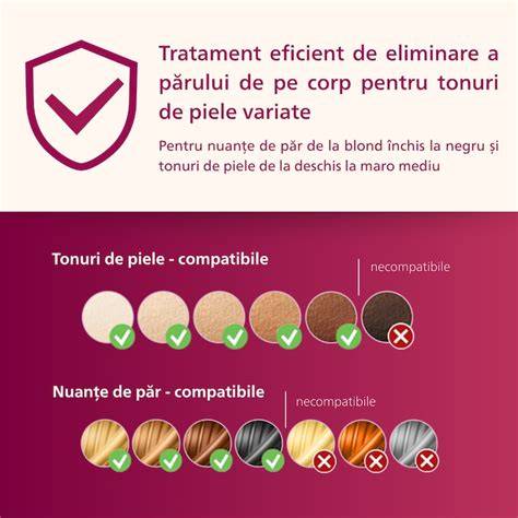 Infografika: Lumea Prestige felépítése és tartozékok áttekintése