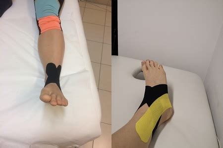 kineziologiai tapasz felhelyezése bokára