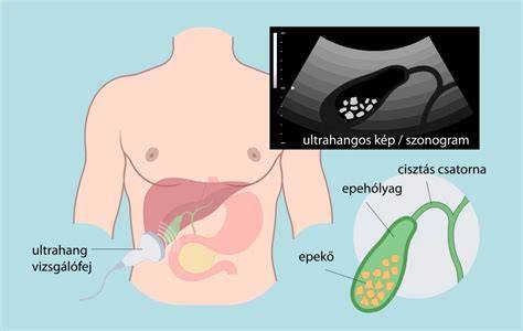 Infografika: A hasi ultrahang fő szervei és a puffadás kapcsolatai