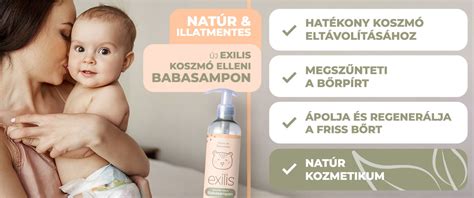 koszmó elleni sampon babáknak infographic