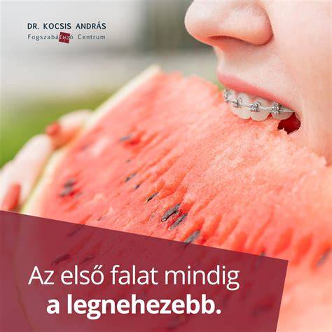 Kendővel rögzített konty látványos példája