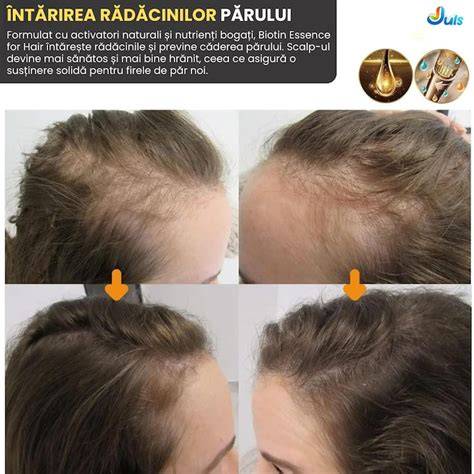 Infografika: Lépésenkénti terv a zsíros haj ápolásához