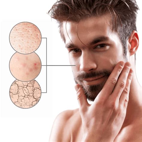 Férfi arcápolás, bőrtisztítás